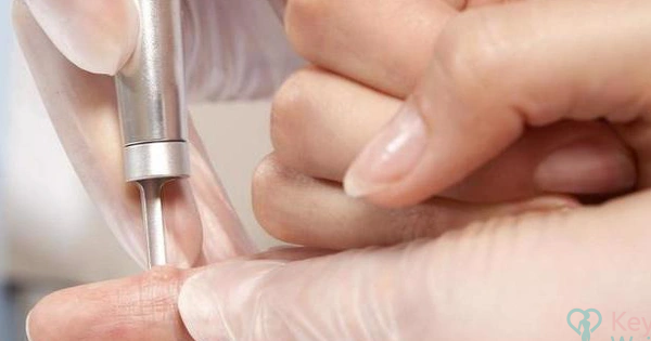 Thuốc chấm mụn cóc có chứa nitrogen lỏng