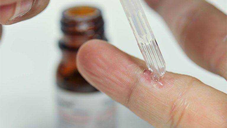Các bước sử dụng thuốc chấm mụn cóc đúng cách