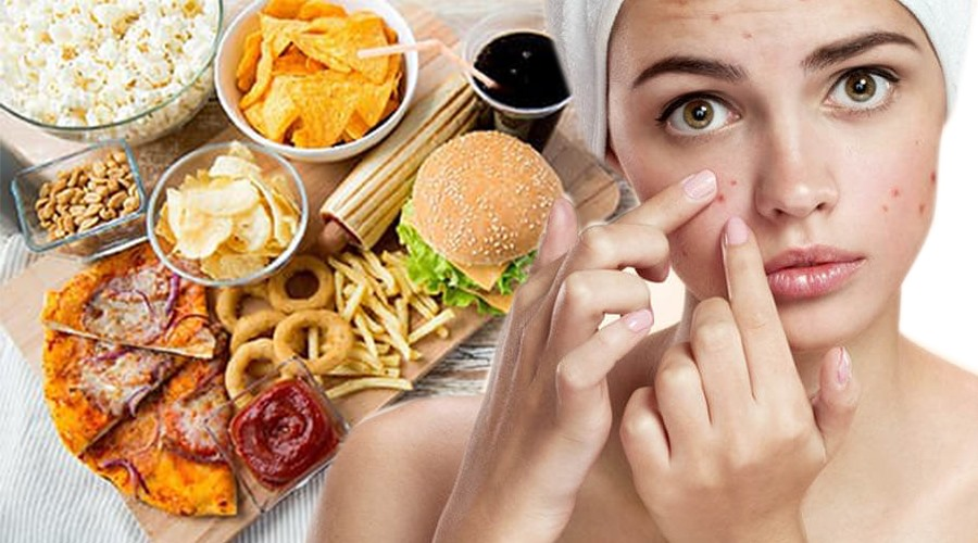 Chế độ ăn uống và lối sống không đúng cũng sẽ dẫn đến mụn viêm trên da