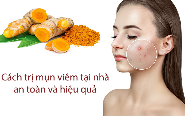 Điều trị tại nhà và những điều cần biết