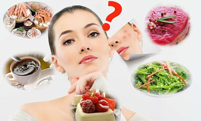 Những lưu ý khi điều trị và chăm sóc da mụn viêm bạn nên biết