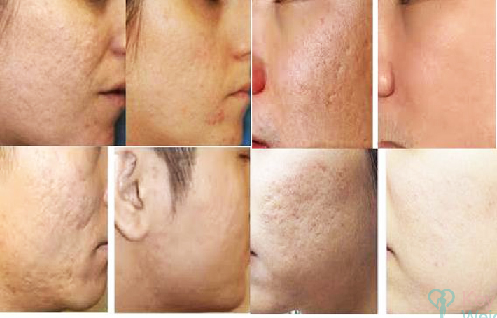 Các thành phần kích thích collagen và phục hồi da hiệu quả