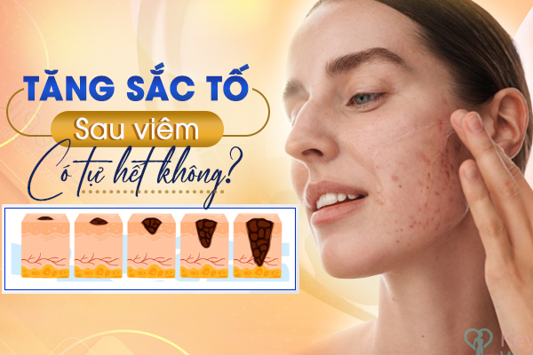 Các thành phần hoạt tính hiệu quả trong điều trị để làm sáng da