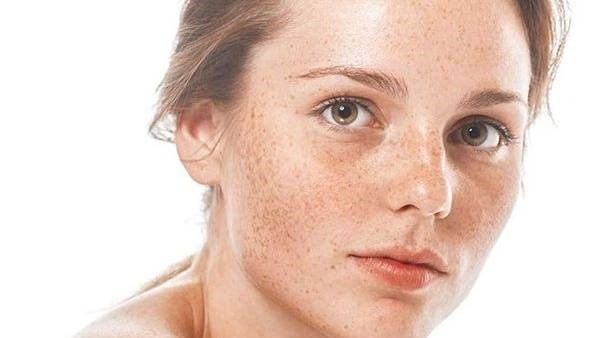 Quá trình hình thành melanin và tăng sắc tố cơ bản