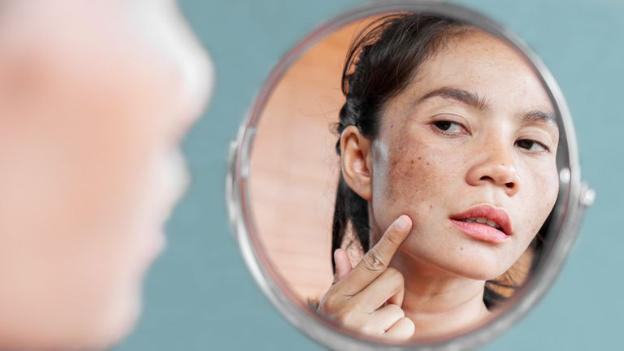 Tăng sắc tố da: Nguyên nhân, phương pháp điều trị và cách phòng ngừa hiệu quả