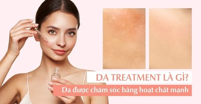 Kinh nghiệm lựa chọn trearment phù hợp nhất với bản thân