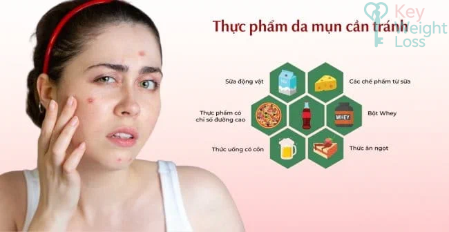 Thực phẩm cần tránh để giảm mụn